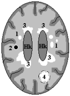 MS-Herde