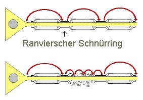 Ranviersche Schnürringe